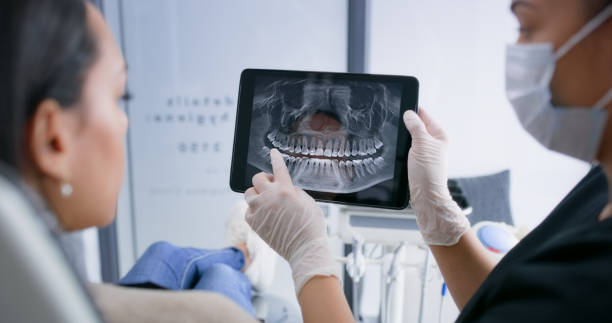 Licensed Dental Implants service in Dexter, MI - Smile Center Dentistry