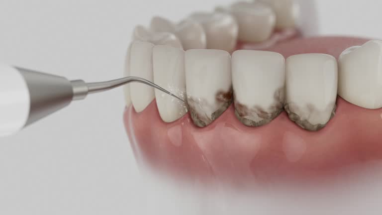 Reliable Dental Implants contractor in Dexter, MI by Smile Center Dentistry
